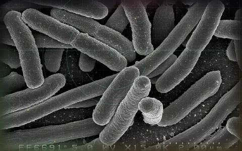 Visual evidence plate for Bacterium