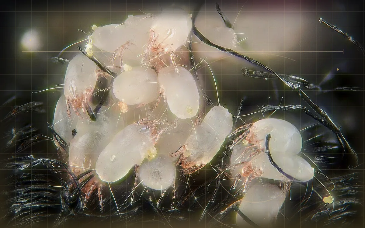 Visual evidence plate for Dust mite